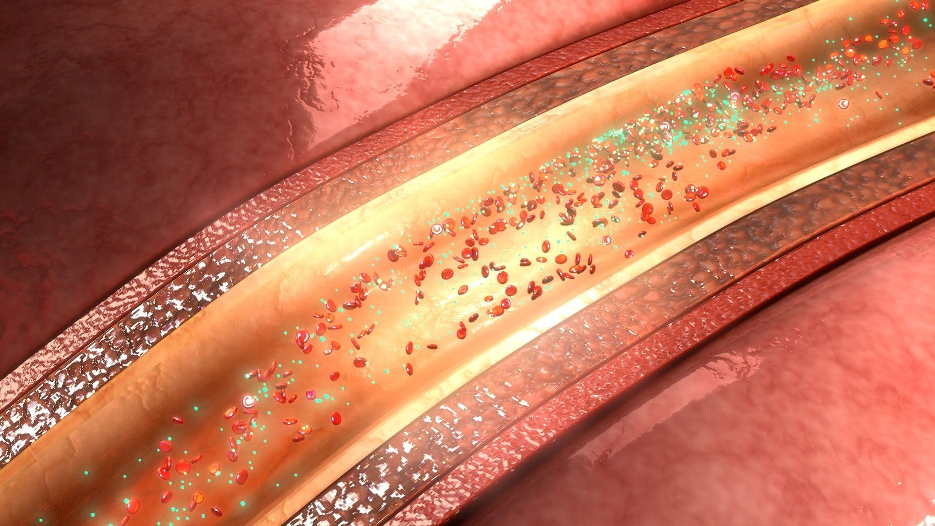 Cholesterin und Blutfette