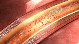 Cholesterin und Blutfette