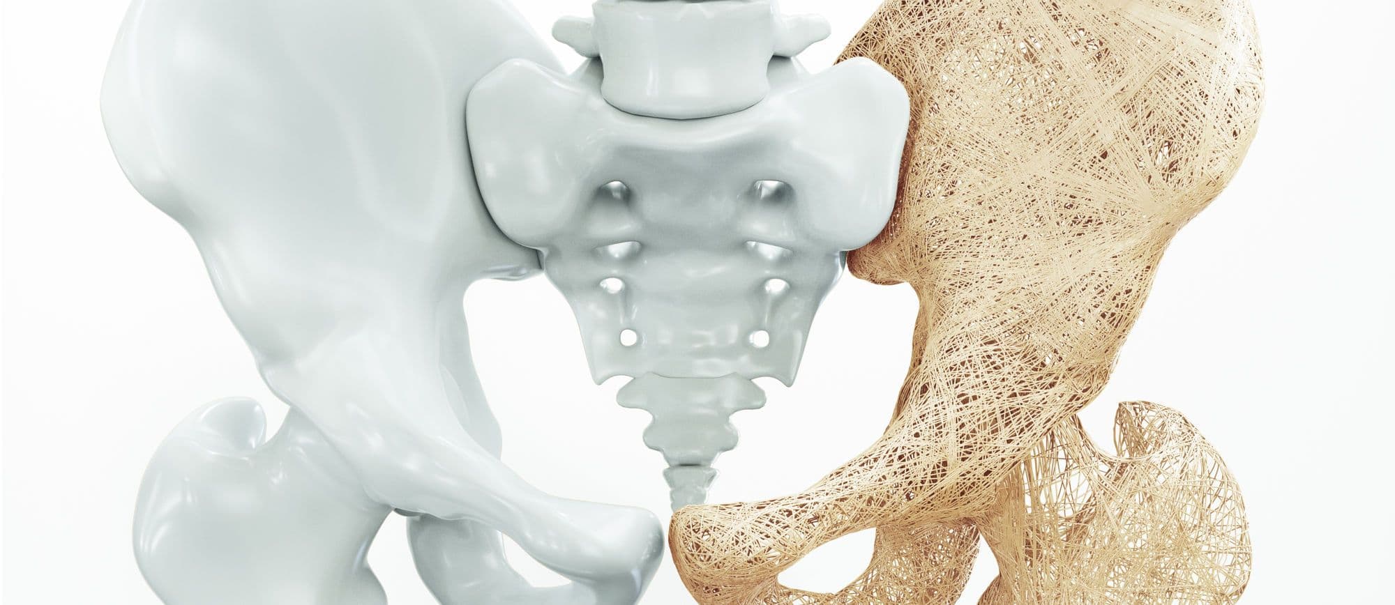 Aminosäuren u.a. gegen Osteoporose